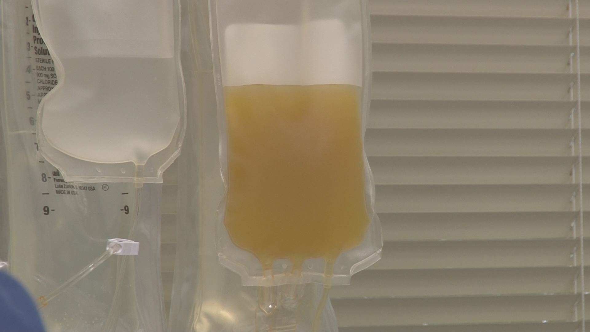 2WTK Selling Plasma For Cash Is it Safe?