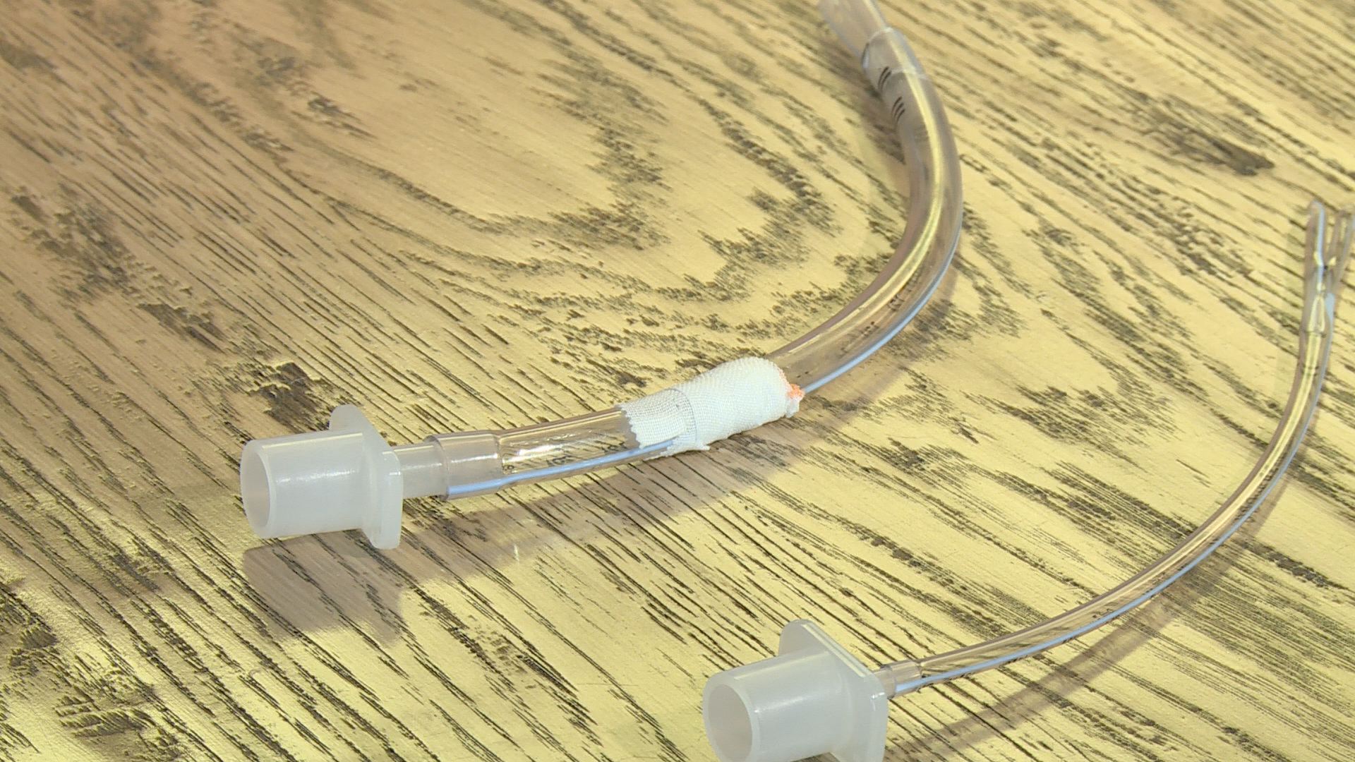 WFBMC Develops Life-Saving Device For Child | wfmynews2.com